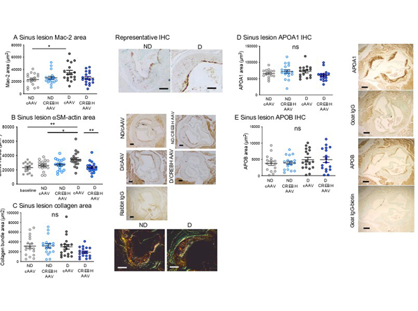 Immunohistochemistry using APOA1